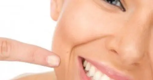 IMPLANTES DENTALES ZHARA 4824100 IMPLANTES DENTALES ZHARA 4824100